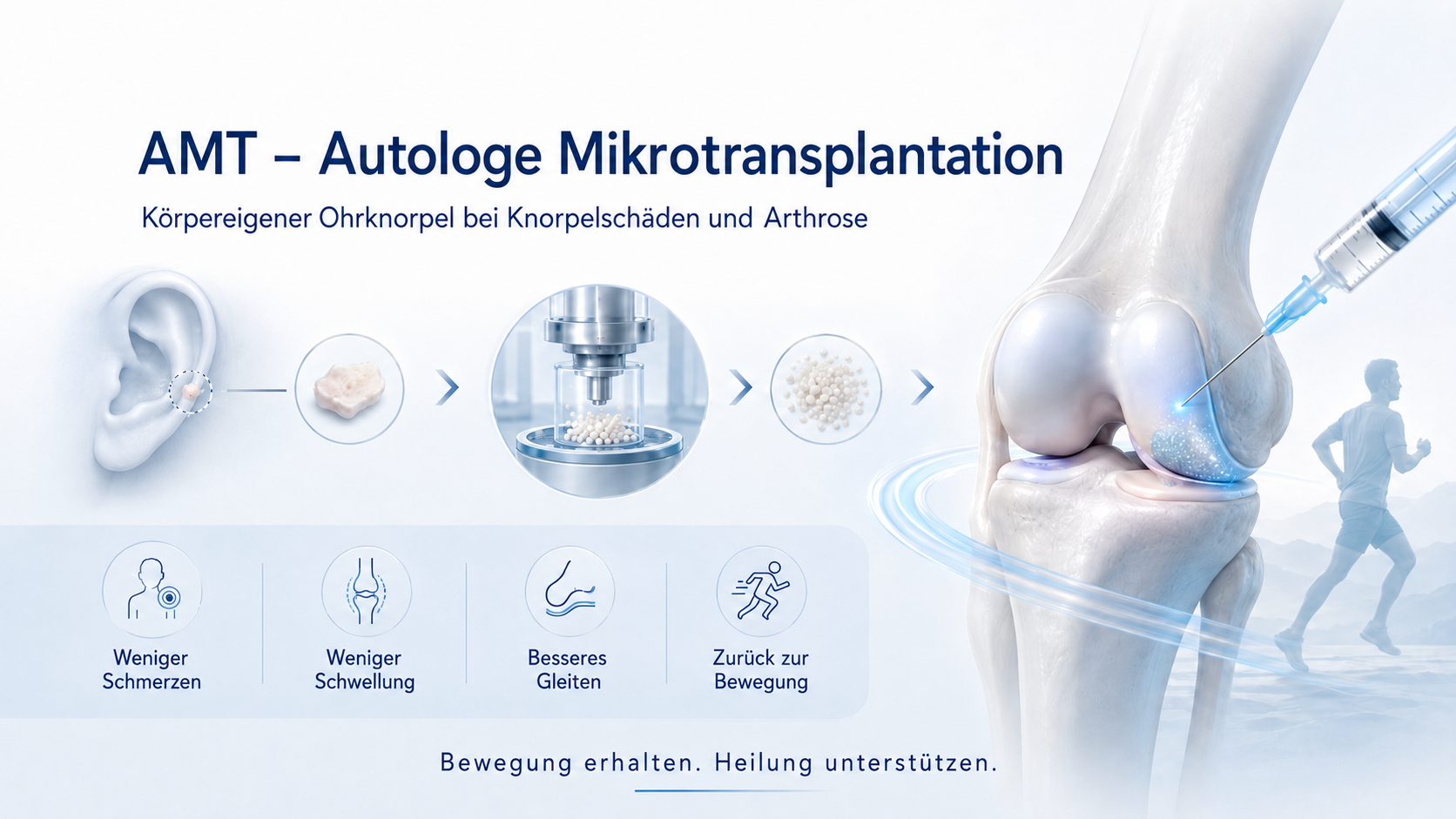 Autologe Mikrotransplantation bei Knorpelschaden